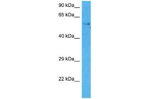 Host:  Mouse  Target Name:  HSF2  Sample Tissue:  Mouse Testis  Antibody Dilution:  1ug/ml (HSF2 Antikörper  (Middle Region))