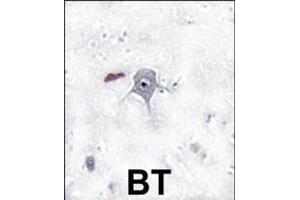 Formalin-fixed and paraffin-embedded human brain tissue reacted with PIK3R2 Antibody (N-term) Ap8028a , which was peroxidase-conjugated to the secondary antibody, followed by DAB staining. (PIK3R2 Antikörper  (N-Term))