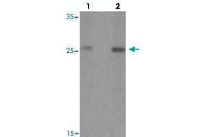 Western blot analysis of PTPRD in HeLa cell lysate with PTPRD polyclonal antibody  at (lane 1) 1 and (lane 2) 2 ug/mL. (PTPRD Antikörper  (N-Term))