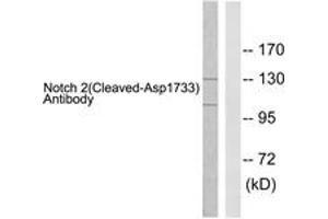 Western blot analysis of extracts from 293 cells, treated with TNF-a 20ng/ml 30', using Notch 2 (Cleaved-Asp1733) Antibody.