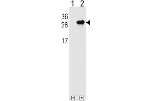 Western Blotting (WB) image for anti-Interleukin 28B (Interferon, lambda 3) (IL28B) antibody (ABIN2999039) (IL28B Antikörper)
