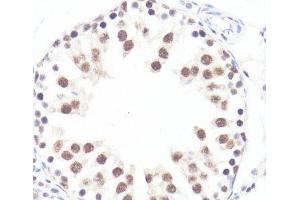 Immunohistochemistry of paraffin-embedded Rat testis using Phospho-MYC(S62) Polyclonal Antibody at dilution of 1:100 (40x lens). (c-MYC Antikörper  (pSer62))