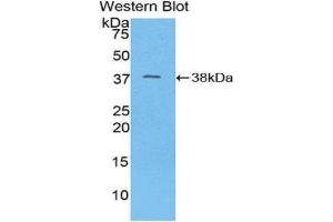 Western Blotting (WB) image for anti-Mitochondrially Encoded NADH Dehydrogenase 1 (MT-ND1) (AA 122-171) antibody (ABIN1859975)