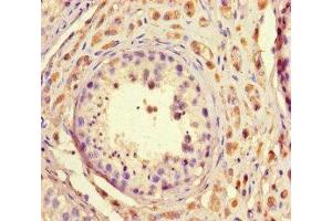 Immunohistochemistry (IHC) image for anti-TAF2 RNA Polymerase II, TATA Box Binding Protein (TBP)-Associated Factor, 150kDa (TAF2) (AA 400-450) antibody (ABIN7172681)