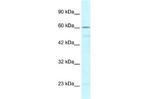 WB Suggested Anti-ZNF212 Antibody Titration:  0. (ZNF212 Antikörper  (N-Term))