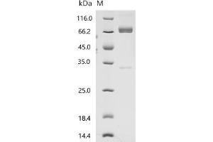 (Tris-Glycine gel) Discontinuous SDS-PAGE (reduced) with 5 % enrichment gel and 15 % separation gel.