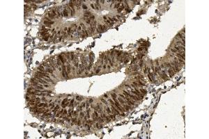 IHC analysis of FOXP1 using anti-FOXP1 antibody (ABIN7602780). (FOXP1 Antikörper  (C-Term))