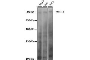 MYH13 抗体  (AA 550-650)