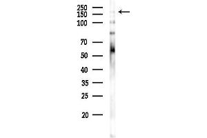 anti-Insulin Receptor Substrate 2 (IRS2) (C-Term) antibody