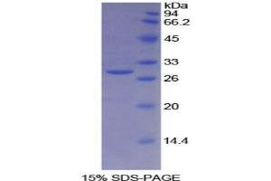 SDS-PAGE analysis of Human BRCA2 Protein. (BRCA2 Protein)