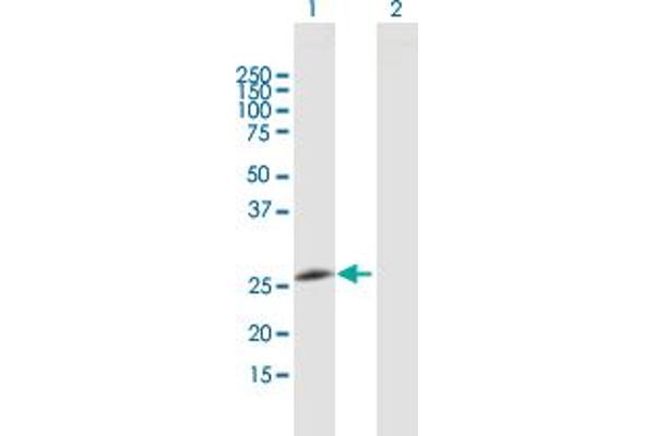 GOSR2 anticorps  (AA 1-213)