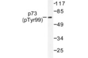 Image no. 1 for anti-Tumor Protein P73 (TP73) (pTyr99) antibody (ABIN318099) (Tumor Protein p73 Antikörper  (pTyr99))