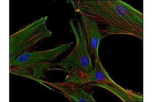 Clathrin Heavy Chain (CLTC) Antikörper