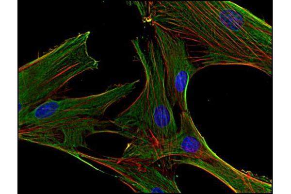 Clathrin Heavy Chain (CLTC) Antikörper