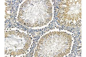 ABIN7095536 and ABIN7099593 at 1/100 staining rat testis tissue by IHC-P.