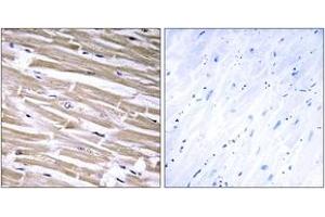 Immunohistochemistry analysis of paraffin-embedded human heart tissue, using B3GALT2 Antibody. (B3GALT2 Antikörper  (AA 373-422))