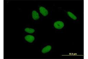 Immunofluorescence of purified MaxPab antibody to ZNF43 on HeLa cell. (ZNF43 Antikörper  (AA 1-803))