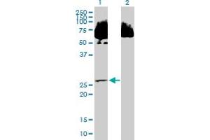 Western Blot analysis of SDR39U1 expression in transfected 293T cell line by SDR39U1 MaxPab polyclonal antibody. (SDR39U1 Antikörper  (AA 1-293))