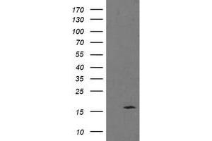 Western Blotting (WB) image for anti-Tumor Protein D52-Like 3 (TPD52L3) antibody (ABIN1501479) (TPD52L3 Antikörper)