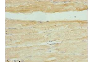 Immunohistochemistry of paraffin-embedded human skeletal muscle tissue using ABIN7169356 at dilution of 1:100 (SERTAD1 Antikörper  (AA 1-236))