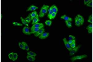 Immunofluorescence staining of HepG2 cells with ABIN7161183 at 1:100, counter-stained with DAPI. (UNC5B Antikörper  (AA 404-517))