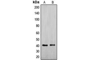 Western blot analysis of ENDOGL1 expression in Jurkat (A), HepG2 (B) whole cell lysates.