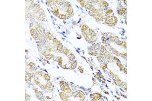 Immunohistochemistry of paraffin-embedded human gastric using DARS2 antibody at dilution of 1:100 (x40 lens). (DARS2 Antikörper)