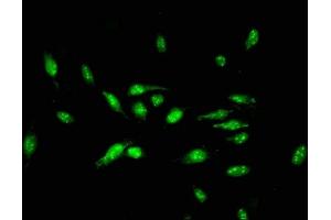 Immunofluorescent analysis of Hela cells using ABIN7150372 at dilution of 1:100 and Alexa Fluor 488-congugated AffiniPure Goat Anti-Rabbit IgG(H+L) (ID3 Antikörper  (AA 27-99))