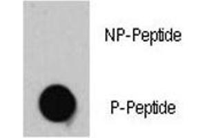 Dot Blot (DB) image for anti-Tuberous Sclerosis 2 (TSC2) (pThr1462) antibody (ABIN3029330)