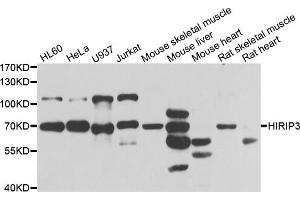 Western blot analysis of extracts of various cell lines, using HIRIP3 antibody (ABIN5974221) at 1/1000 dilution. (HIRIP3 Antikörper)
