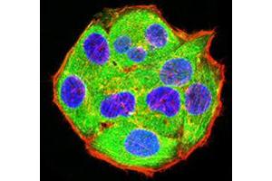Immunofluorescence (IF) image for anti-Adenosine Deaminase, RNA-Specific (ADAR) (AA 1085-1223) antibody (ABIN5611214)