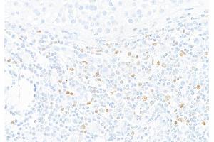 Immunohistochemistry (IHC) image for anti-T-Bet (AA 485-535) antibody (ABIN7455151)