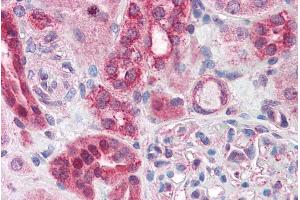 Immunohistochemistry (IHC) image for anti-ATP-Binding Cassette, Sub-Family D (Ald), Member 4 (ABCD4) (Internal Region) antibody (ABIN335110)