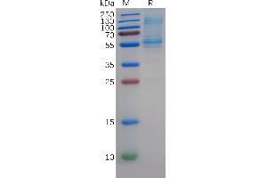 Human Protein, His Tag on SDS-PAGE under reducing condition.