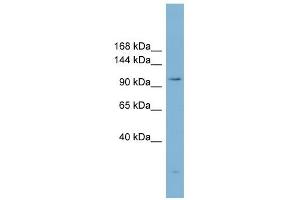 ACLY antibody used at 1 ug/ml to detect target protein. (ACLY Antikörper  (Middle Region))