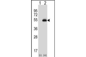 Western blot analysis of X6 (arrow) using rabbit polyclonal X6 Antibody (ABIN656844 and ABIN2846051).