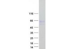 Nyctalopin Protein (NYX) (Myc-DYKDDDDK Tag)