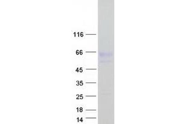 Nyctalopin Protein (NYX) (Myc-DYKDDDDK Tag)