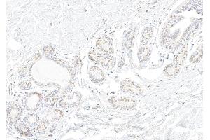 anti-Small Nuclear Ribonucleoprotein 200kDa (U5) (SNRNP200) (AA 400-450) antibody