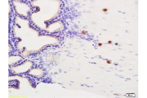 Formalin-fixed and paraffin embedded rat seminal vesicle labeled with Anti-Phospho-Dab1 (Tyr232) Polyclonal Antibody, Unconjugated (ABIN684343) at 1:200 followed by conjugation to the secondary antibody and DAB staining.