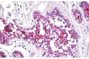 Image no. 2 for anti-Mucin 1 (MUC1) antibody (ABIN1502278) (MUC1 Antikörper)