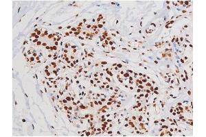 ABIN6267365 at 1/200 staining Human heart tissue sections by IHC-P.