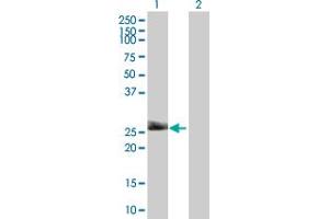 Western Blot analysis of THY1 expression in transfected 293T cell line by THY1 MaxPab polyclonal antibody. (CD90 Antikörper  (AA 1-161))
