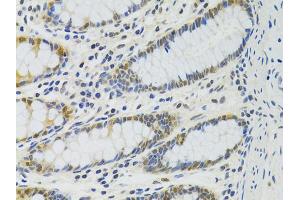 Immunohistochemistry of paraffin-embedded human colon using PPP4C antibody (ABIN5971135) at dilution of 1/100 (40x lens). (PPP4C Antikörper)