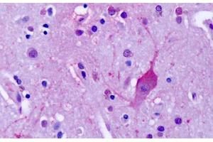 Anti-MGLUR4 antibody IHC staining of human brain, cortex, neurons. (Metabotropic Glutamate Receptor 4 Antikörper  (C-Term))