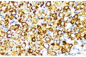 Immunohistochemistry of paraffin-embedded Rat ovary using PBEF / NAMPT Polyclonal Antibody at dilution of 1:100 (40x lens). (NAMPT Antikörper)