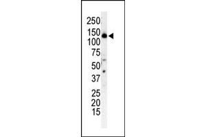 Western Blotting (WB) image for anti-Phosphoinositide 3-kinase Regulatory Subunit 4 (PIK3R4) (N-Term) antibody (ABIN360462) (PIK3R4 Antikörper  (N-Term))