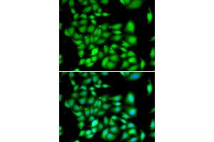 Immunofluorescence analysis of A549 cells using TREX1 antibody (ABIN5974106). (TREX1 Antikörper)