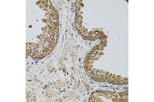 Immunohistochemistry (IHC) image for anti-Selectin P (Granule Membrane Protein 140kDa, Antigen CD62) (SELP) (AA 30-200) antibody (ABIN6147503)