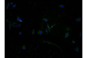 Immunofluorescence staining of HepG2 cells with ABIN7140161 at 1:100, counter-stained with DAPI. (TAS2R5 Antikörper  (AA 149-164))